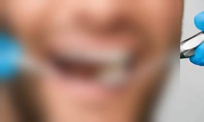 Photo of Kang Dental in Fontana